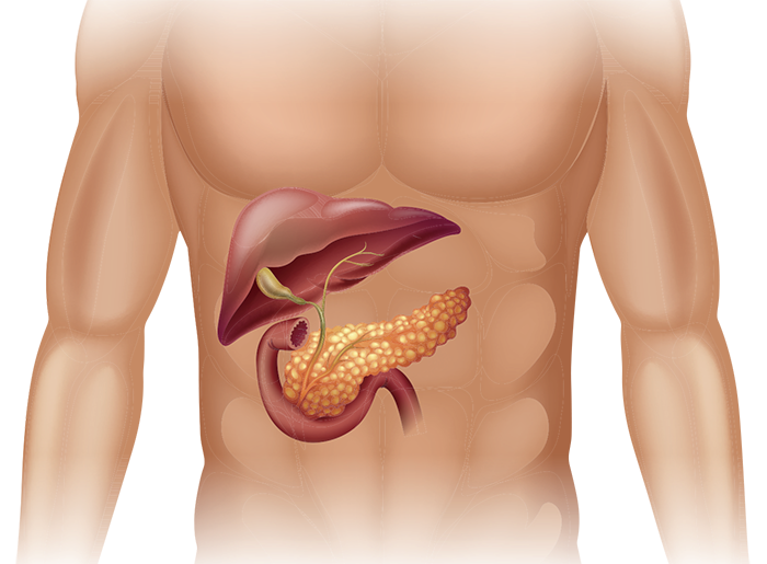 cancerul_pancreasului_02