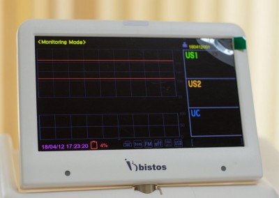 Cardiotocomonitoare_pentru_maternitatea_05