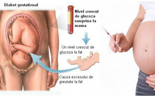 Diabetul_gestational_1
