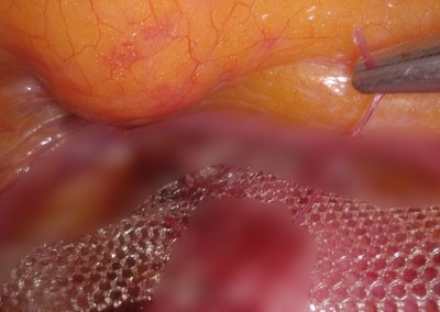 STILL IMAGE