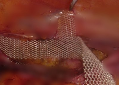 STILL IMAGE
